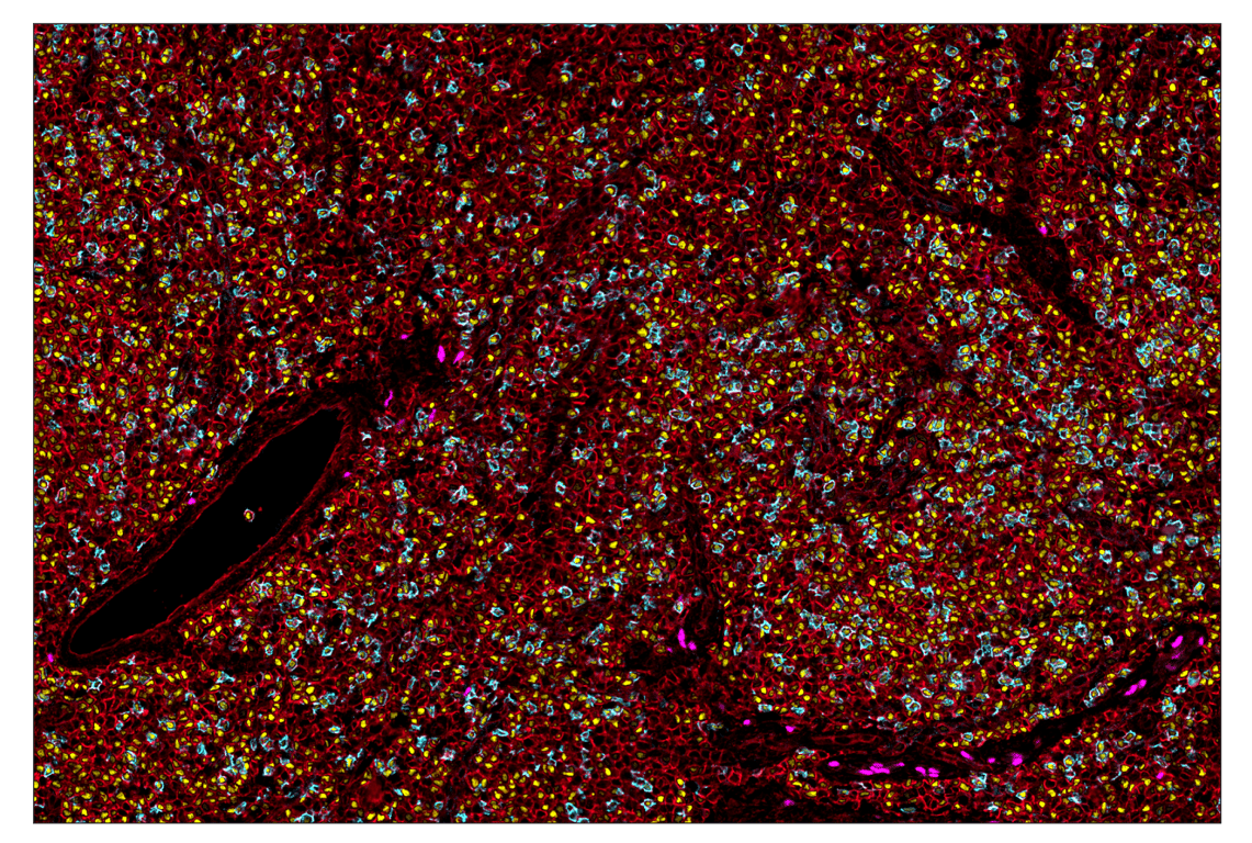Immunohistochemistry Image 1: Sox10 (E6B6I) & CO-0080-647 SignalStar<sup>™</sup> Oligo-Antibody Pair