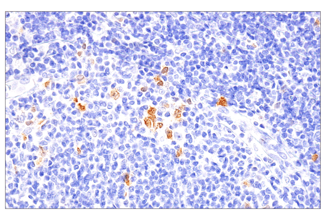 Immunohistochemistry Image 5: Chk1 (2G1D5) Mouse mAb