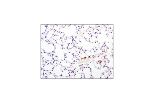 Immunohistochemistry Image 1: TIM-3 (D3M9R) Rabbit Monoclonal Antibody