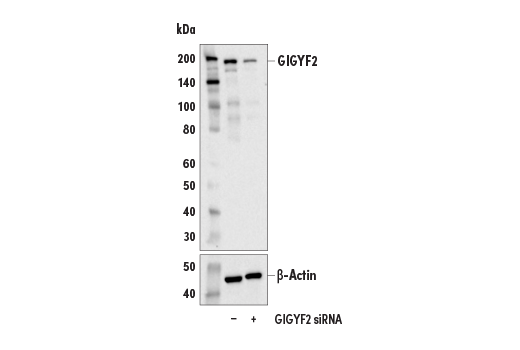 Western Blotting Image 3: GIGYF2 (E7F7I) Rabbit Monoclonal Antibody