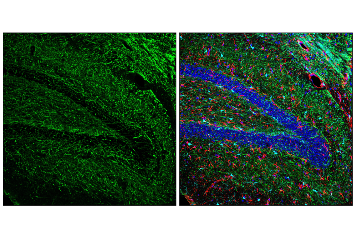 Immunofluorescence Image 1: Neurofilament-H (E9C9Z) Mouse Monoclonal Antibody