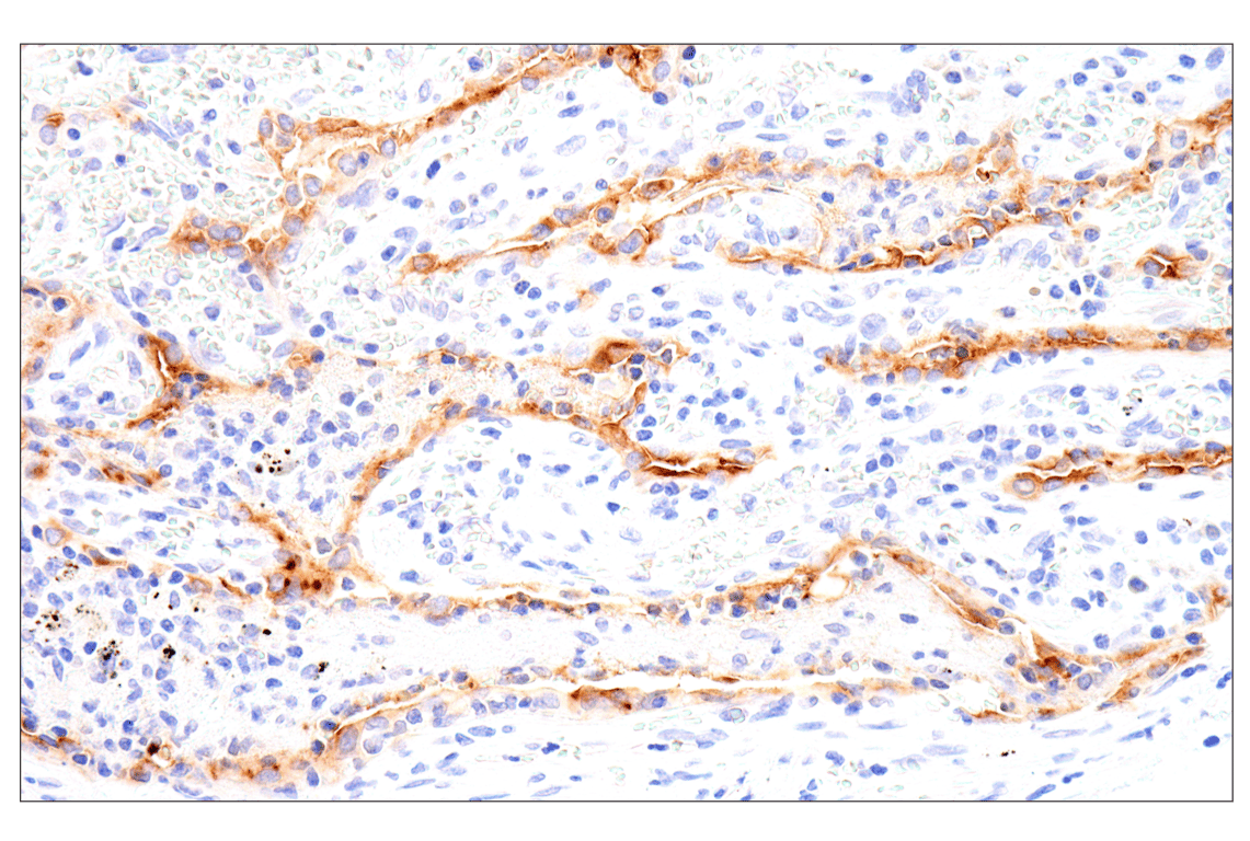 Immunohistochemistry Image 1: Folate Receptor Alpha/FOLR1 (BN3.2) Mouse mAb