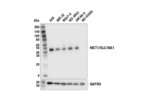 Western Blotting Image 1: MCT1/SLC16A1 (E7F6Y) Rabbit mAb