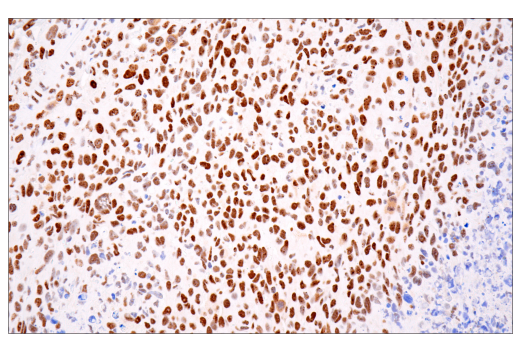 Immunohistochemistry Image 4: ATRX (E5X7O) Rabbit Monoclonal Antibody