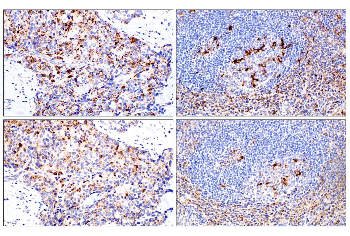 undefined Image 44: Genetics of Parkinson's Disease: Lysosomal Dysfunction Antibody Sampler Kit