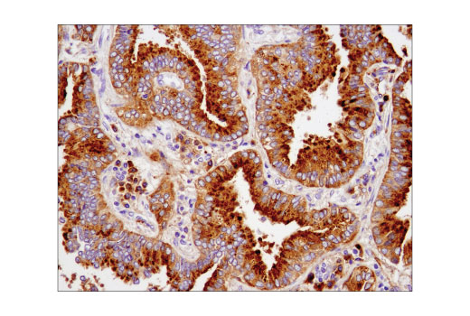Immunohistochemistry Image 2: CD63 (D4I1X) Rabbit Monoclonal Antibody (BSA and Azide Free)