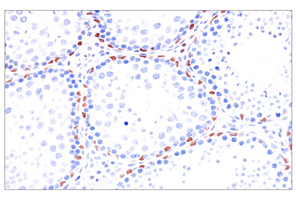 GATA-6 (D61E4) XP® Rabbit mAb (#5851) Datasheet With Images