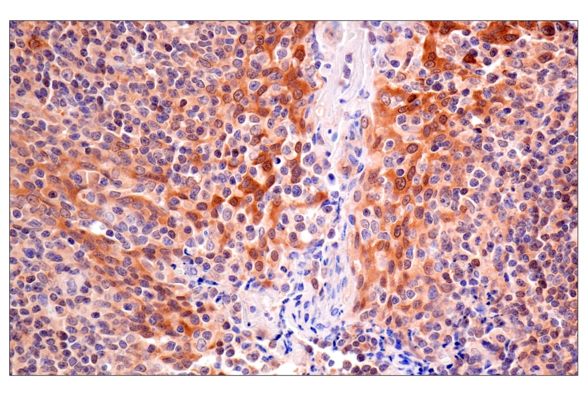 Immunohistochemistry Image 5: ACBP/DBI (E6K8G) Rabbit Monoclonal Antibody