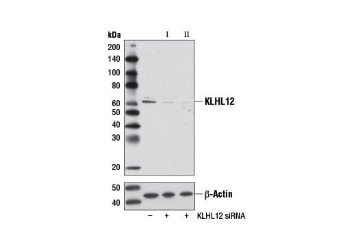 undefined Image 1: SignalSilence<sup>®</sup> KLHL12 siRNA II