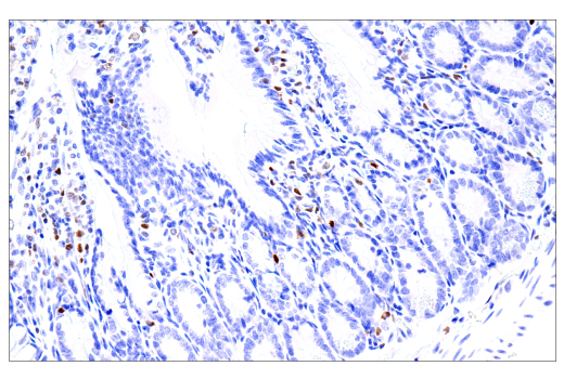 Immunohistochemistry Image 3: RUNX3/AML2 (D6E2) Rabbit Monoclonal Antibody