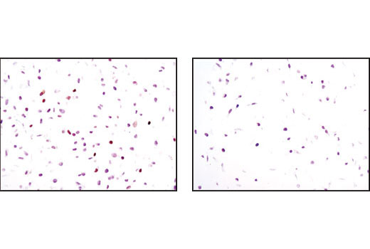 Immunohistochemistry Image 1: p21 Waf1/Cip1 (12D1) Rabbit Monoclonal Antibody (BSA and Azide Free)