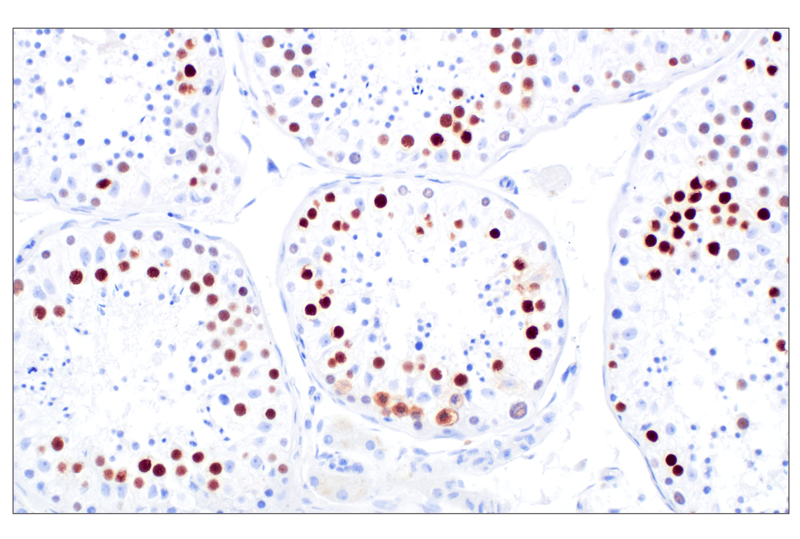 Immunohistochemistry Image 3: CT45 (F7S2I) Rabbit Monoclonal Antibody