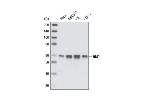 undefined Image 1: Akt Isoform Antibody Sampler Kit