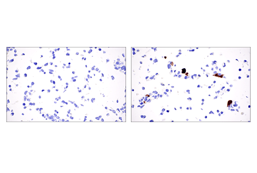 Immunohistochemistry Image 2: S100A8 (E4F8V) Rabbit Monoclonal Antibody (BSA and Azide Free)