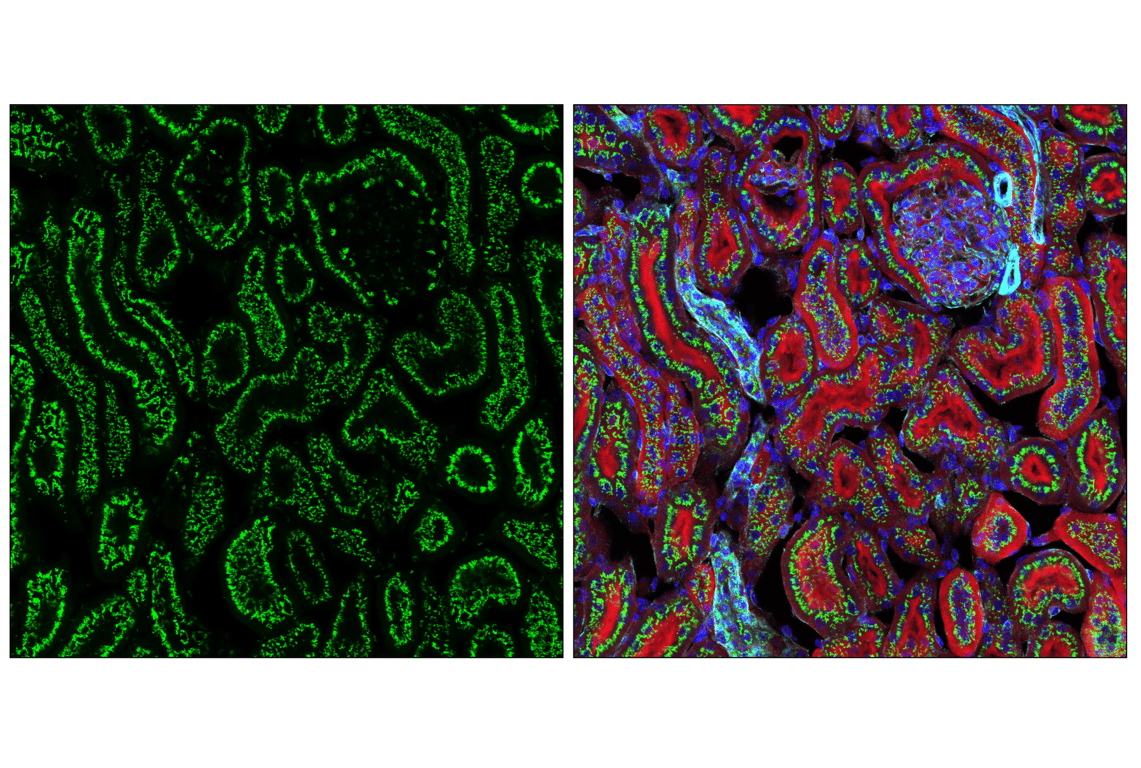 Immunofluorescence Image 4: GM130 (E9Z6S) Rabbit Monoclonal Antibody