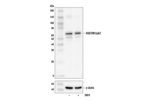 Western Blotting Image 4: SQSTM1/p62 (D6M5X) Rabbit Monoclonal Antibody