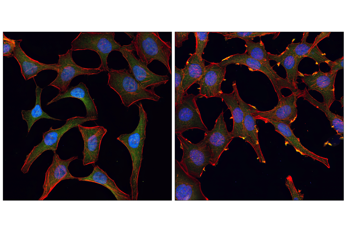 Immunofluorescence Image 1: Akt (pan) (11E7) Rabbit Monoclonal Antibody (BSA and Azide Free)