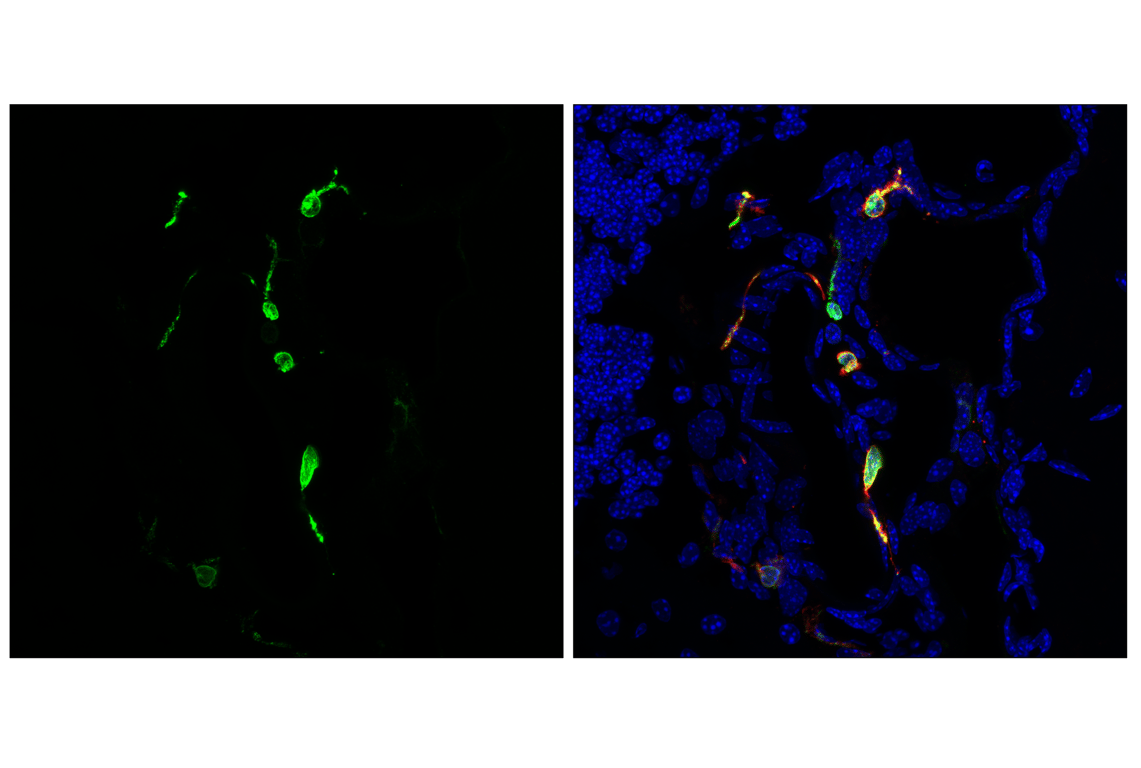 Immunofluorescence Image 2: CD74 (F6K1S) Rabbit Monoclonal Antibody