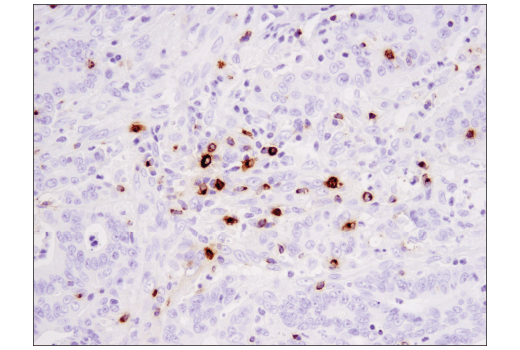 undefined Image 64: Human Exhausted CD8<sup>+</sup> T Cell IHC Antibody Sampler Kit