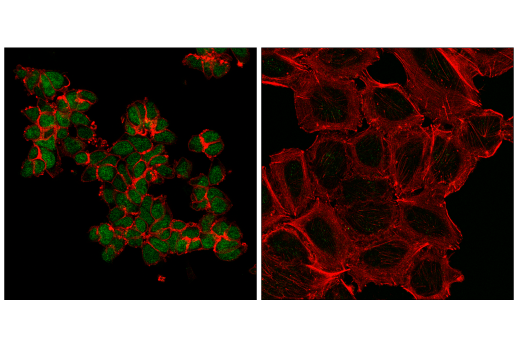 Immunofluorescence Image 1: Tox2 (E3N3G) Rabbit Monoclonal Antibody