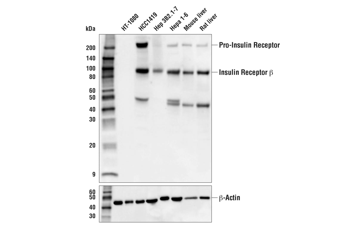 Western Blotting Image 1: Insulin Receptor β (E9L5V) XP<sup>®</sup> Rabbit mAb (BSA and Azide Free)