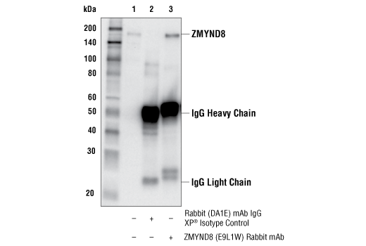 Immunoprecipitation Image 1: ZMYND8 (E9L1W) Rabbit Monoclonal Antibody