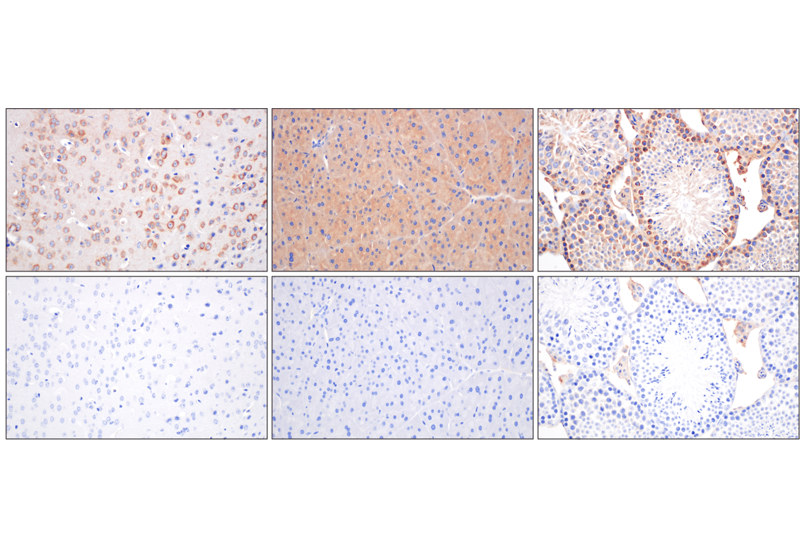 Immunohistochemistry Image 11: EEA1 (E9Q6G) Mouse Monoclonal Antibody