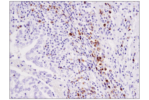 undefined Image 39: Human Exhausted CD8<sup>+</sup> T Cell IHC Antibody Sampler Kit