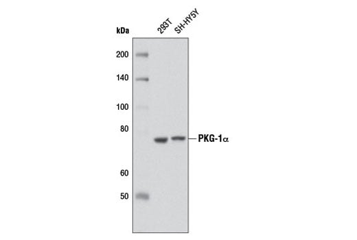 Western Blotting Image 2: PKG-1 alpha (D10G2) Rabbit Monoclonal Antibody