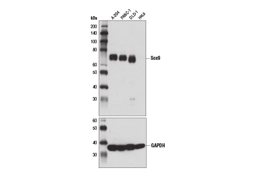 Western Blotting Image 1: Sox9 (D8G8H) Rabbit mAb