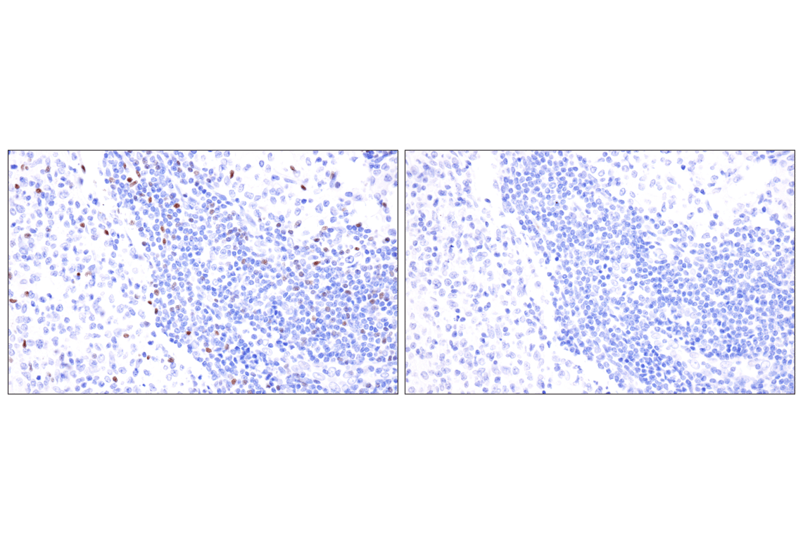 Immunohistochemistry Image 10: FoxP3 (221D) Mouse Monoclonal Antibody