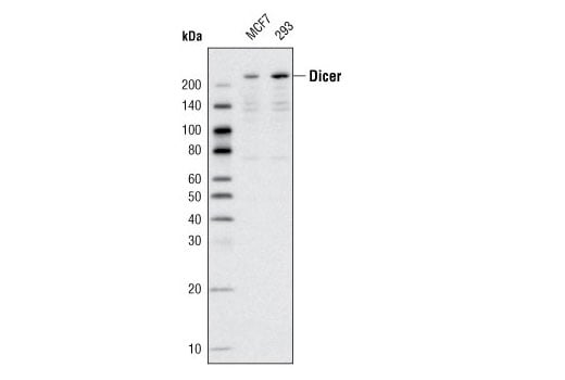 undefined Image 4: RNAi Machinery Antibody Sampler Kit