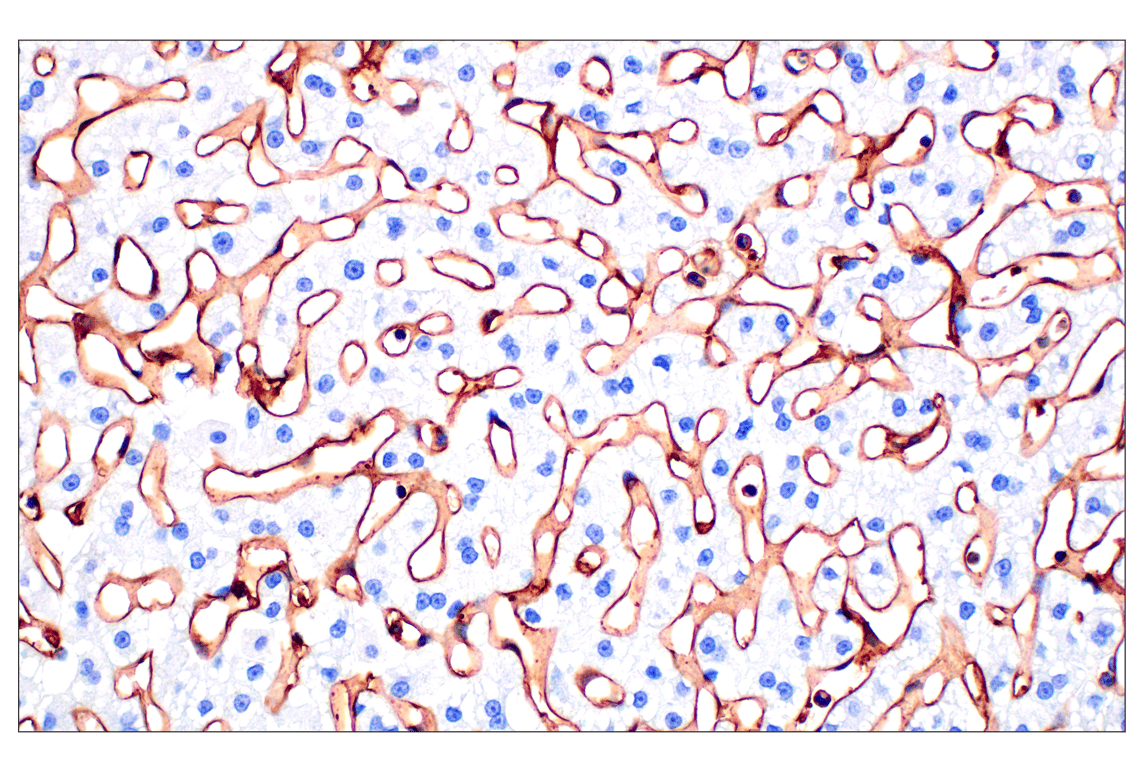 Immunohistochemistry Image 1: CD31 (PECAM-1) (F8M3S) Rabbit Monoclonal Antibody