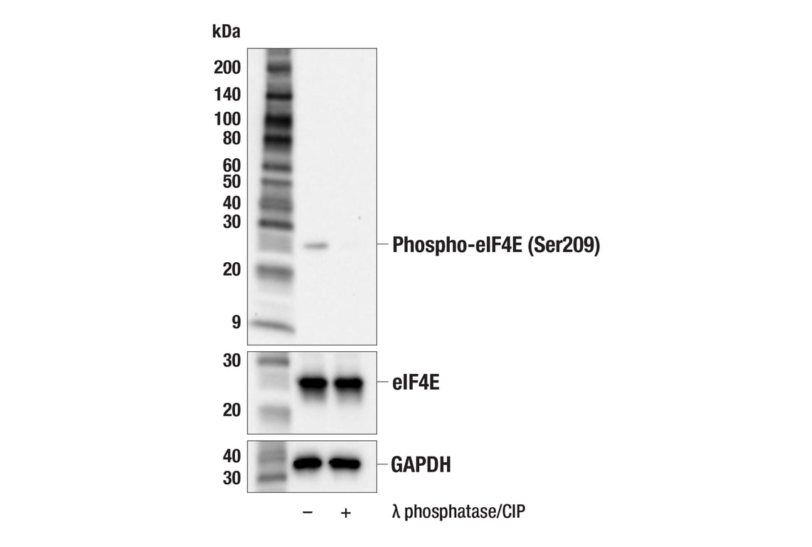 Western Blotting Image 2: Phospho-eIF4E (Ser209) (F4E5N) Rabbit Monoclonal Antibody