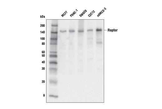 undefined Image 1: PhosphoPlus<sup>®</sup> Raptor (Ser792) Antibody Duet
