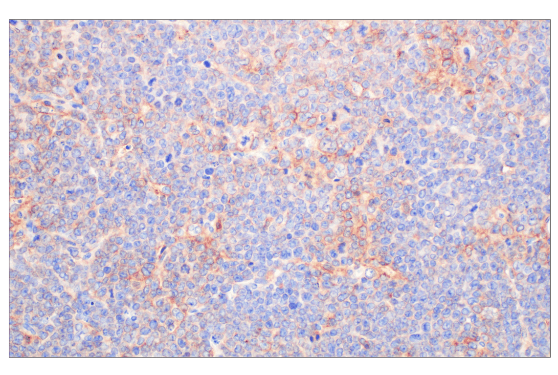 Immunohistochemistry Image 1: CCL3/MIP-1 alpha (F2M8Q) Rabbit Monoclonal Antibody