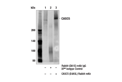 Immunoprecipitation Image 1: CASC5 (E4A5L) Rabbit Monoclonal Antibody