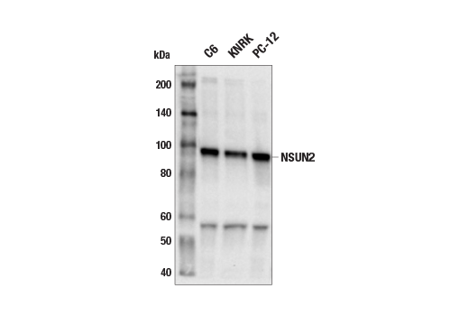 Western Blotting Image 3: NSUN2 (E6N6I) Rabbit Monoclonal Antibody