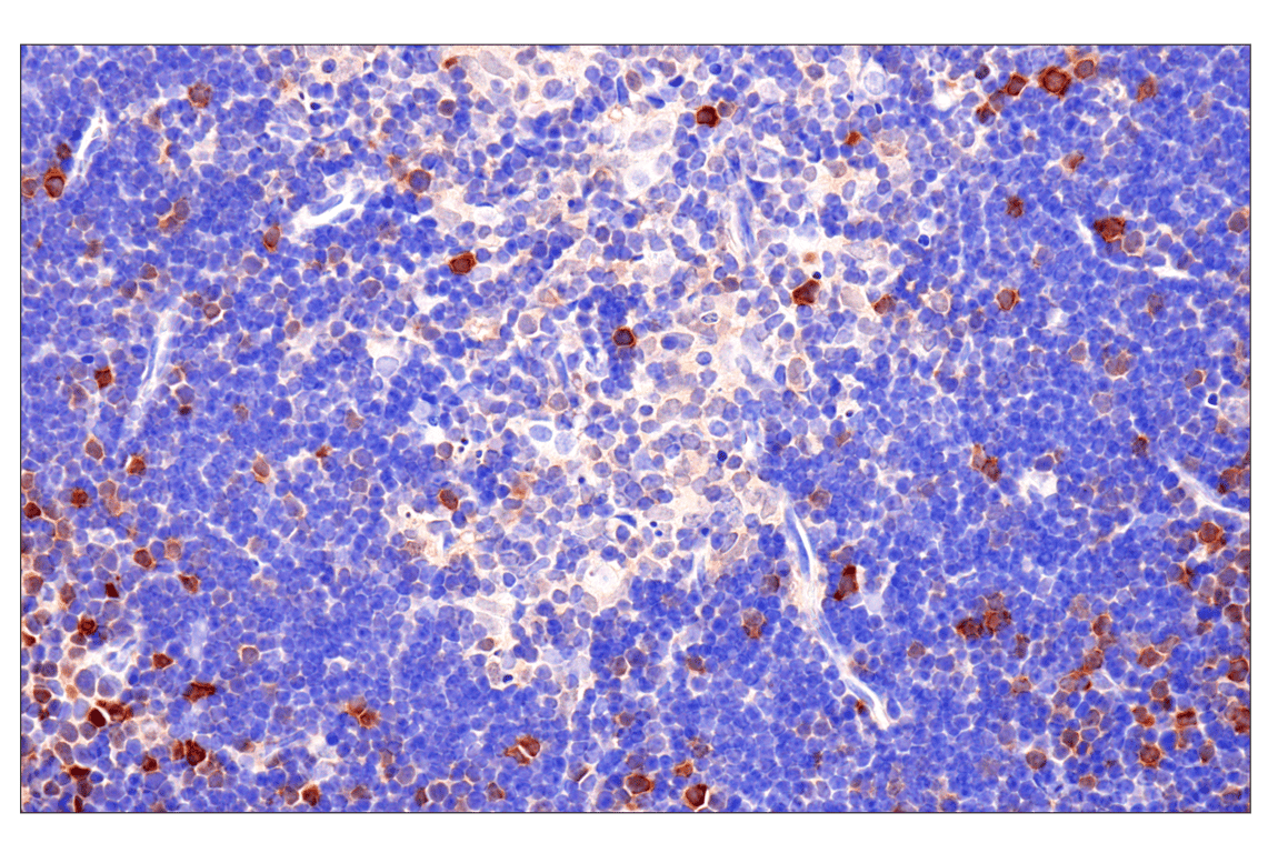 Immunohistochemistry Image 15: CDK6 (E3E3Q) Rabbit Monoclonal Antibody