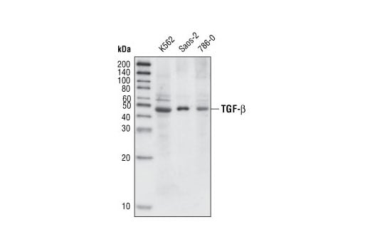 Western Blotting Image 3: TGF-beta (56E4) Rabbit Monoclonal Antibody