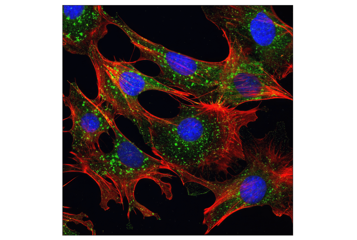 mTOR (7C10) Rabbit mAb | Cell Signaling Technology