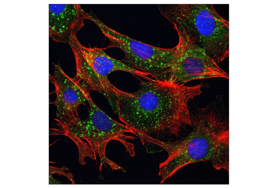 undefined Image 49: Cannabinoid Receptor 1 Downstream Signaling Antibody Sampler Kit