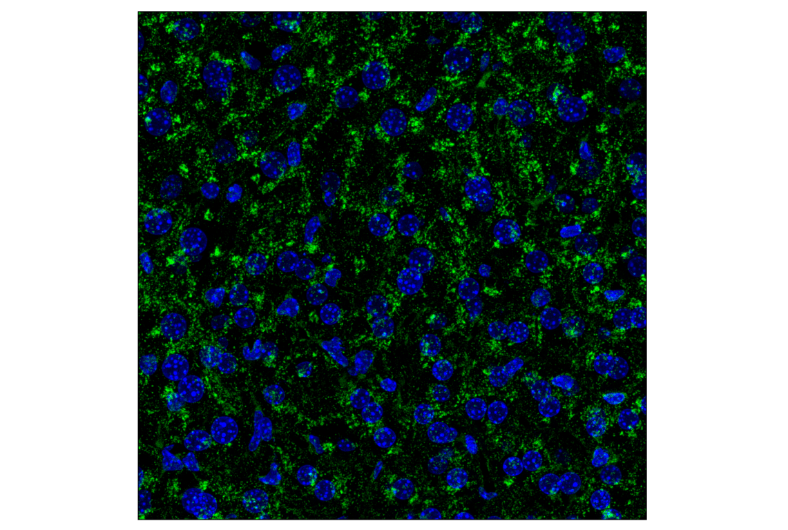 Immunofluorescence Image 2: LAMP2A (F1A5A) Rabbit Monoclonal Antibody
