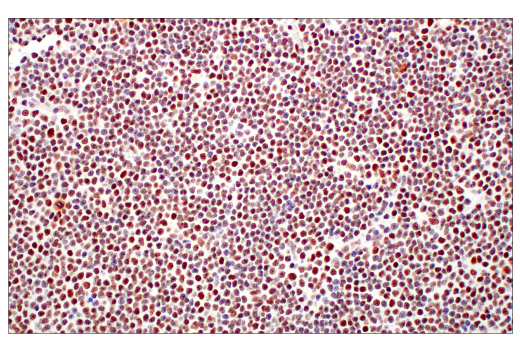 Immunohistochemistry Image 3: XRCC1 (E4A3V) Rabbit Monoclonal Antibody
