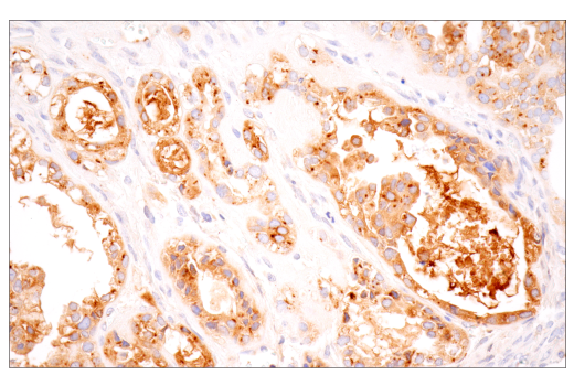 Immunohistochemistry Image 2: Furin (E2Y2F) Rabbit Monoclonal Antibody