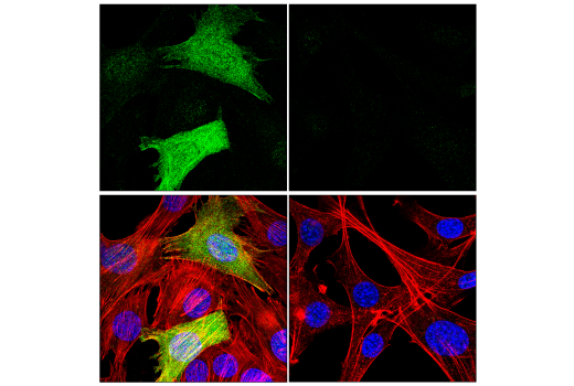 Immunofluorescence Image 1: Transgelin/TAGLN Antibody