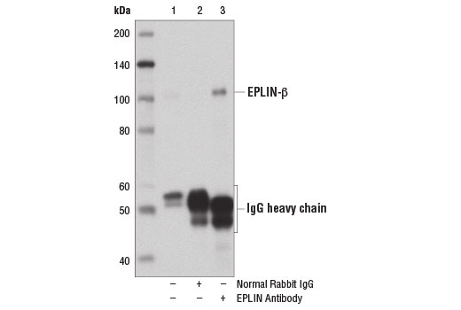 Immunoprecipitation Image 2: EPLIN Antibody