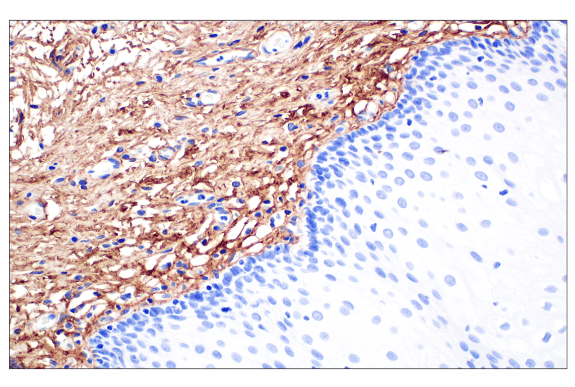 Immunohistochemistry Image 3: COL6A1 (E9U3B) Rabbit Monoclonal Antibody