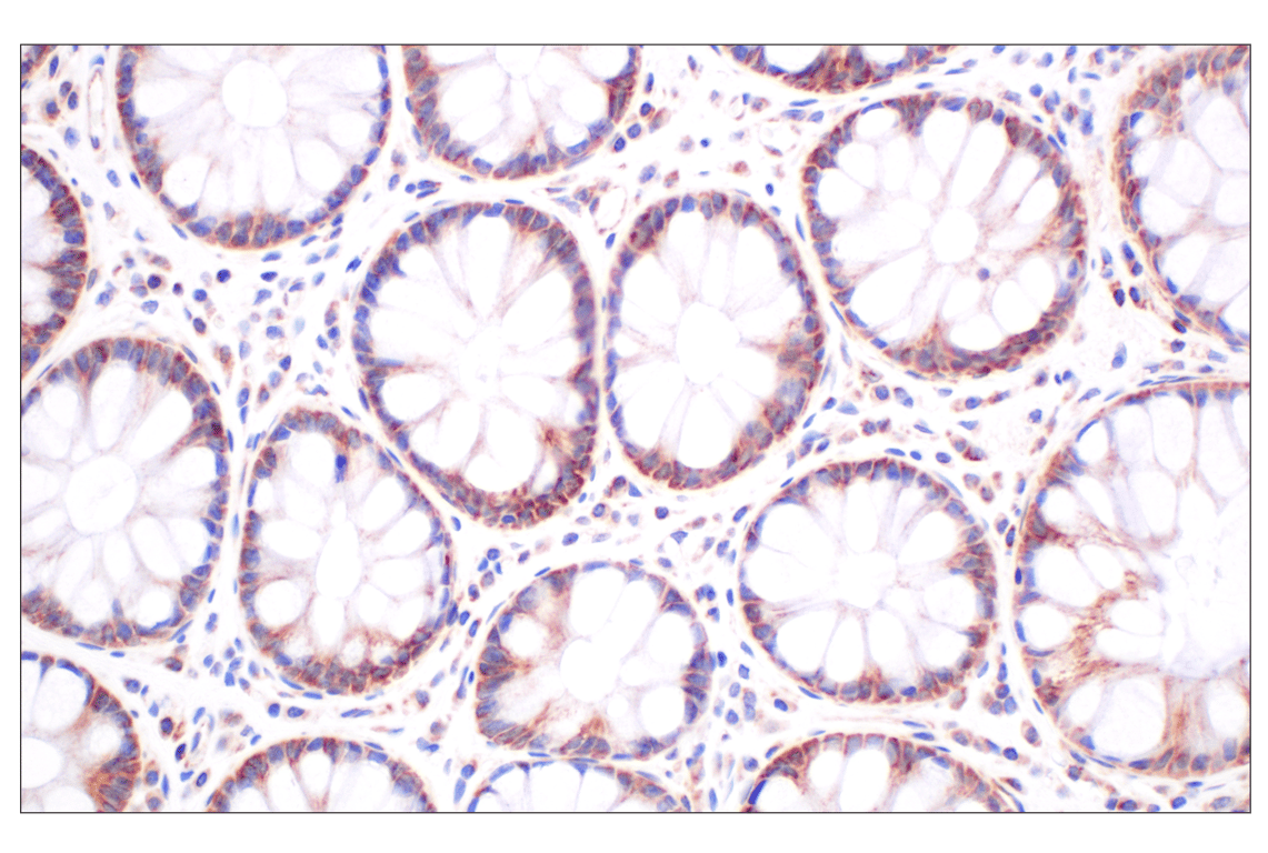 Immunohistochemistry Image 7: CPT1A (E3Y1V) Rabbit Monoclonal Antibody