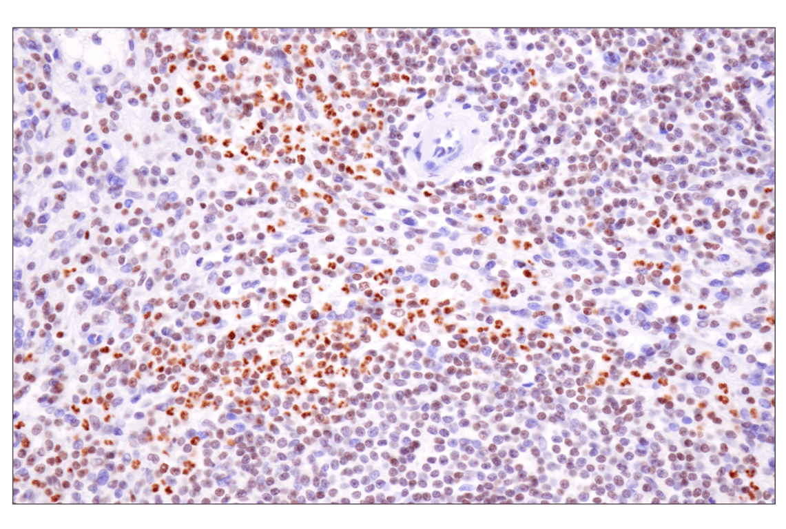 Immunohistochemistry Image 6: Acetyl-Histone H4 (Lys16) (E2B8W) Rabbit Monoclonal Antibody